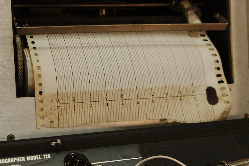 1970s Electronic Schiotz Tonographer - ONLINE ONLY