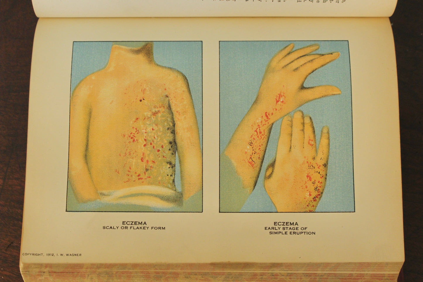 "Domestic Medical Practice" 1918 Book